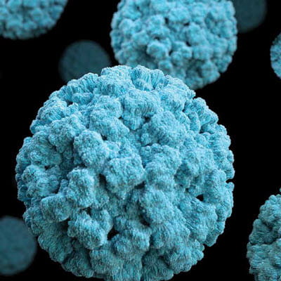 Norovirus what impact does it have on your restaurant